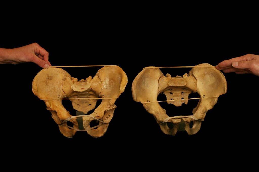 Same size pelvis,difference in the space in the joint | Why your Squat looks different than others | How Anatomy affects Squat Form 